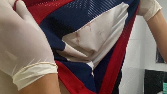 จับฆ่าเผาหนุ่มโบลต์! ศพใส่เก๋งขับไปทั่วโทรหาแม่ให้ช่วย ตร.เค้นแฟนสาว 5 จับฆ่าเผา