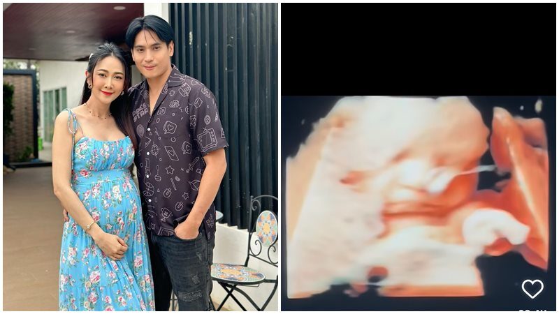 ยุ้ย จีรนันท์ อวดคลิปอัลตร้าซาวด์ลูกยิ้มให้