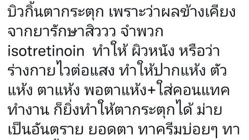 บิวกิ้น เผยสาเหตุ