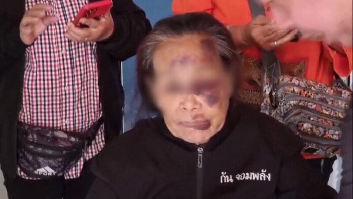 ไม่ถึงตาย