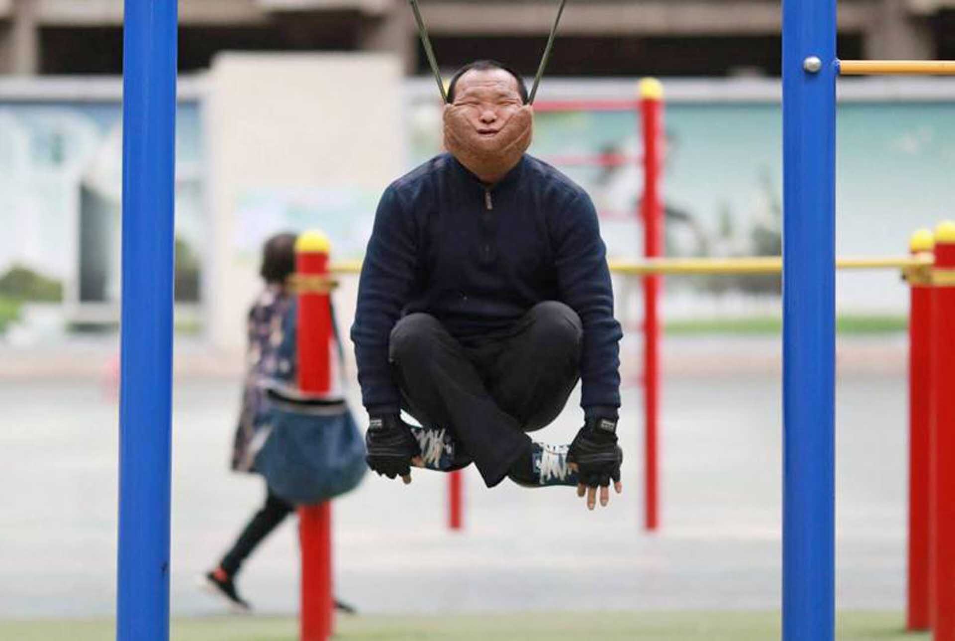 ชายจีนดับคาอุปกรณ์ออกกำลังกาย “เชือกพยุงคาง” ผู้เชี่ยวชาญเตือนอย่าหาทำ