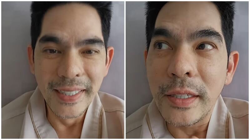บิ๊ก ศรุต อัพเดตอาการหลังผ่าตัดหัวเข่า