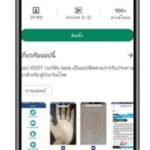 Application TBVDOT สำหรับผู้ป่วยวัณโรค สถาบันโรคทรวงอก
