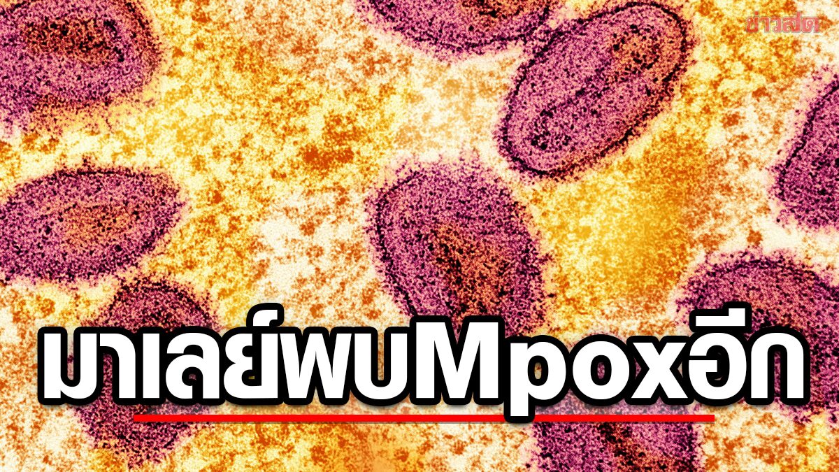 Smallpox Scare in Malaysia: Second Case Confirmed, But No Cause for Panic