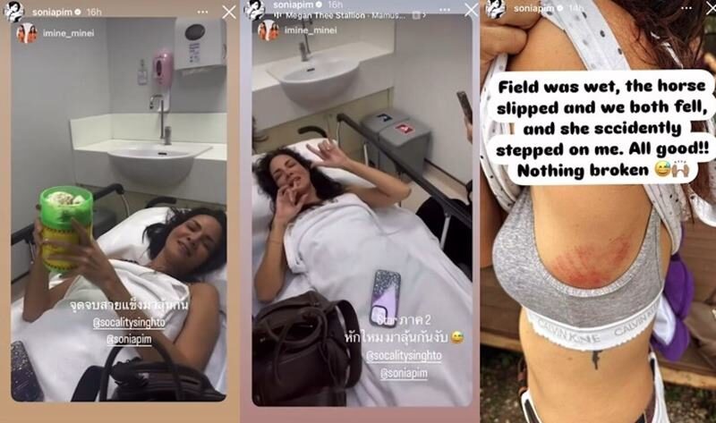 พิม ซอนย่า อัพเดตอาการกระดูกซี่โครงหัก หลังอุบัติเหตุตกม้า
