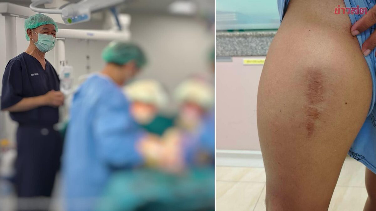 Shocking Diagnosis: The 5kg Fat Cell Tumor That Changed My Life Forever