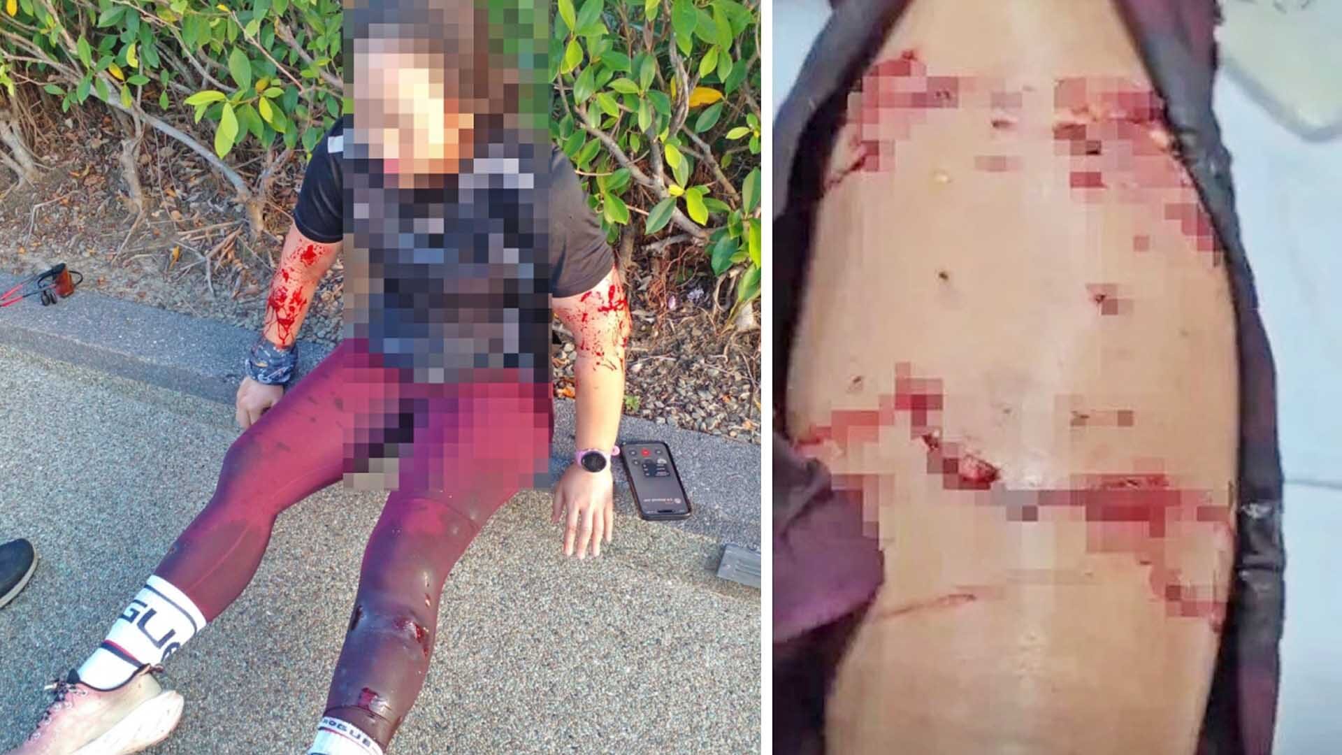แม่บ้านมาเลย์เลือดอาบ “ฝูงนากรุมกัดยับ” ขณะวิ่งออกกำลังกายในสวนสาธารณะ