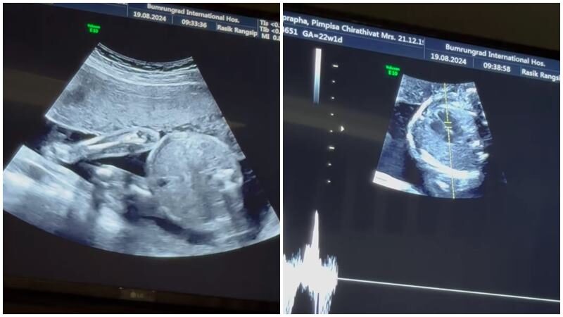 แพร พิมพิศา พี่สาว พีช พชร ประกาศข่าวดี ทายาทหมื่นล้านมาแล้ว