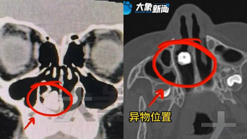 Image of a metal screw