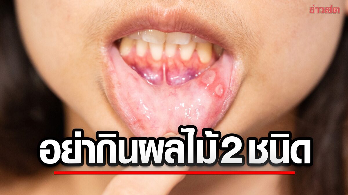 Warning Signs in Your Body: 2 Fruits to Avoid If You Have Mouth Ulcers or Diarrhea, According to a Doctor - News Directory 3