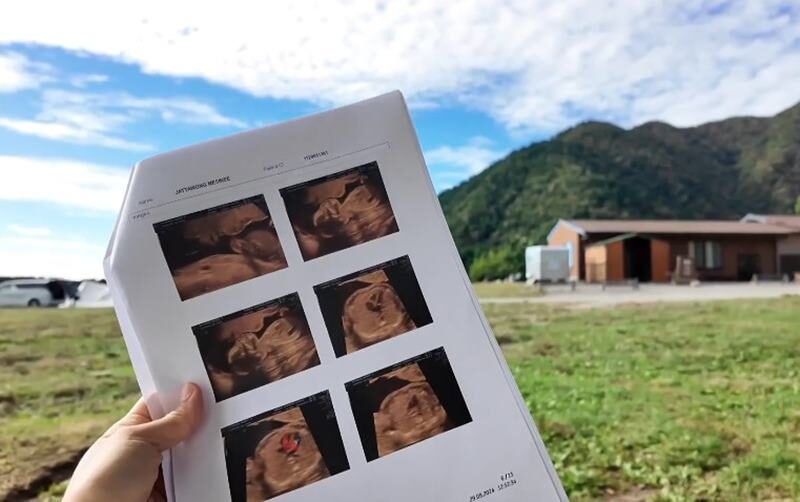 เฮลั่น! โจอี้ บอย ขึ้นแท่นว่าที่คุณพ่อป้ายแดง ภรรยา เตย เมษินี ตั้งท้องแล้ว