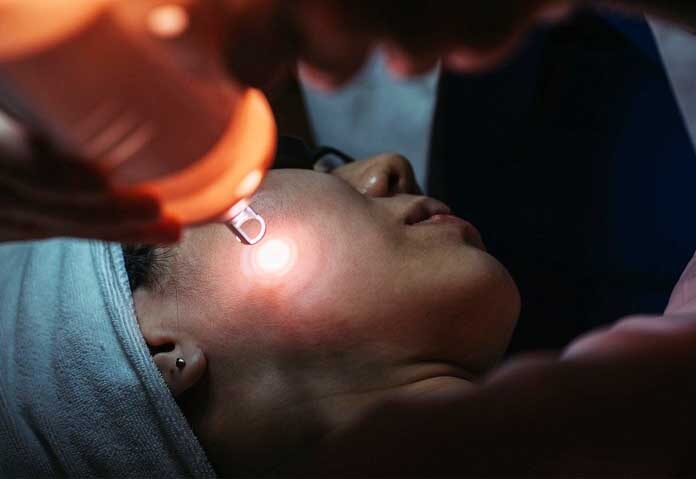 สาวจีนเข้ารักษาเลเซอร์ “จี้กระ” บนใบหน้า โชคร้ายแพ้ยาชา 10 วันต่อมา “ดับสลด”