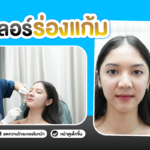 ฟิลเลอร์ร่องแก้ม รวมข้อดีและเคล็ดลับเติมเต็มผิวร่องแก้มให้ดูเต็มขึ้น!