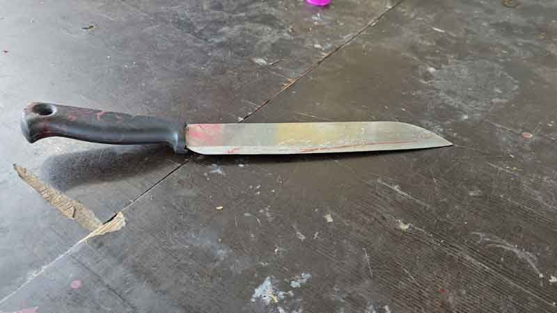 เมียฉุนจัด ผัวเมาฉลองปีใหม่ไม่ยอมกลับบ้าน คว้ามีดฟันหน้าจมูกแหว่ง