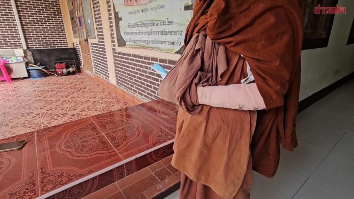 เจ้าอาวาสโหด ทุบพระลูกวัดเจ็บสาหัส แขนซ้ายหัก กล่าวหาทำเครื่องเสียงพัง