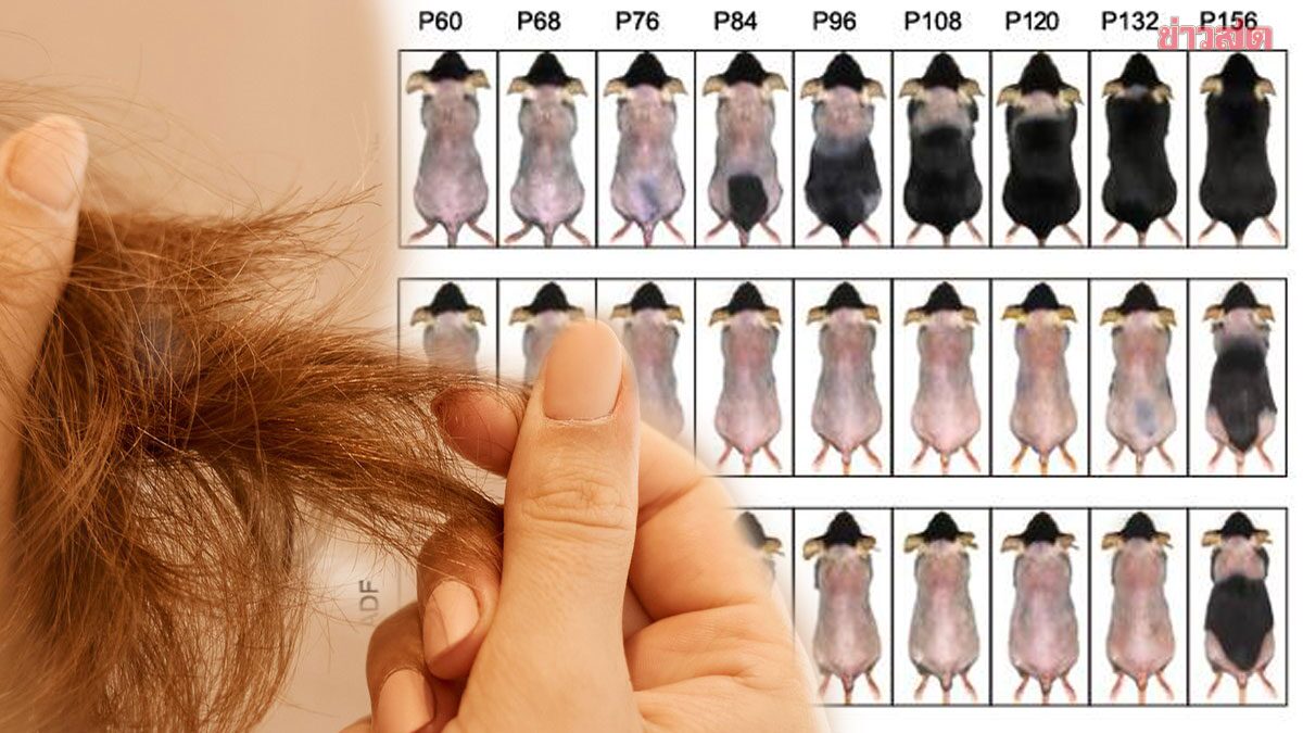 .คนชอบทำ IF ต้องรู้ ผลวิจัยชี้ เซลล์ต้นกำเนิดของรูขุมขนถูกทำลาย ทำผมบาง.