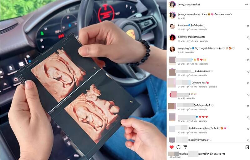 ยิว ฉัตรมงคล เผยรูปอัลตร้าซาวด์ ลูกคนที่2 มาแล้ว พี่ยูจิน ตื่นเต้นสุด