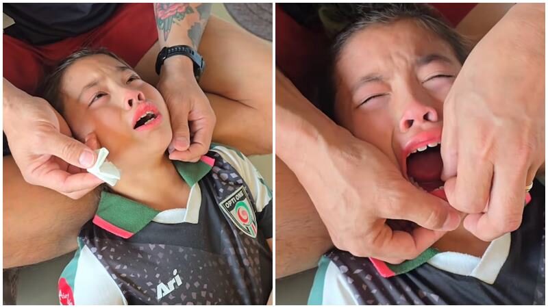 พ่อกาย รับบทหมอฟันจำเป็น ช่วยดึงฟันให้ลูกสาว ชาวเน็ตแห่เมนต์เคยผ่านจุดนั้นมาแล้ว