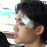 เอาเรื่องให้ถึงที่สุด ญาตินศ.หนุ่มยืนยัน เหตุวัยรุ่นต่างสถาบันกร่าง บุกใช้ปืนตบหน้าเย็บ 4 เข็ม
