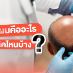 ปลูกผม คืออะไร มีเทคนิคอะไรบ้าง นอกจากผ่าตัดมีวิธีอื่นอีกไหม?