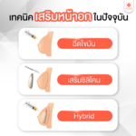 เสริมหน้าอก เหมาะกับใคร เลือกเทคนิคไหนดี วิธีดูแลตัวเองหลังทำ?