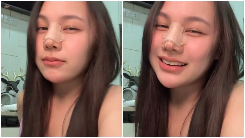 ลิลลี่ ซัดแรง ฝากถึงคนบูลลี่ ทำจมูกมาแล้วไม่สวย ควรไปเพิ่มส่วนสูง