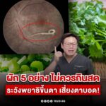 เตือนผัก 5 อย่าง กินสด ระวังพยาธิขึ้นตา เสี่ยงตาบอด ขึ้นฉ่ายฝรั่ง แชมป์เรื่องพยาธิ แนะควรล้างให้สะอาด