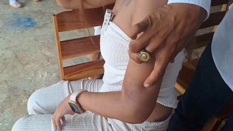 Former dancer speaks out on brutal abuse by boyfriend | News by Thaiger
