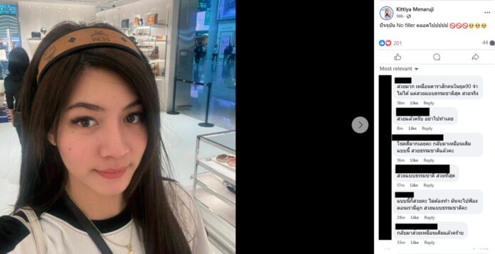 สาวแชร์ประสบการณ์ แพ้ฟิลเลอร์ จากหน้าตาดี ทำแย่หนัก ชาวเน็ตบอกอย่าทำเลย สวยแล้ว