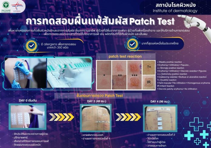 สถาบันโรคผิวหนัง เผยวิธีทำ 'Patch Test' หาสาเหตุผื่นผิวหนังอักเสบ-ลดใช้ยาไม่จำเป็น