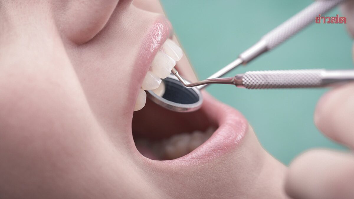 .หมอฟันเตือน 'ขูดหินปูน' เอง ด้วย เครื่องอัลตร้าโซนิค เสี่ยงโรคช่องปาก ลามติดเชื้อ.