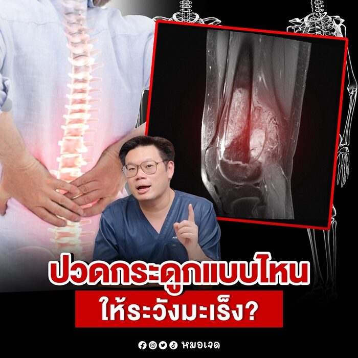 หมอเจด ไขข้อสงสัย "ปวดกระดูก" แบบไหน โรคร้ายกำลังซ่อนอยู่โดยไม่รู้ตัว เตือน อย่าชะล่าใจเด็ดขาด เพราะมันอาจเกี่ยวกับ "มะเร็ง" เช็กที่นี่ อาการแบบไหนเสี่ยง