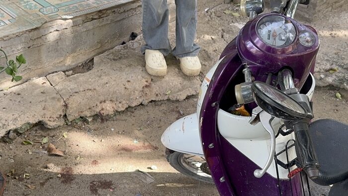 Boy hospitalised after dog attack prompts compensation dispute | News by Thaiger