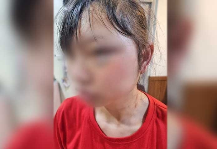 สั่งคุกชายเกาหลีใต้ “เตะหน้า” คนงานสาวเวียดนาม-เจ็บหนักรักษาตัวนาน 2 สัปดาห์