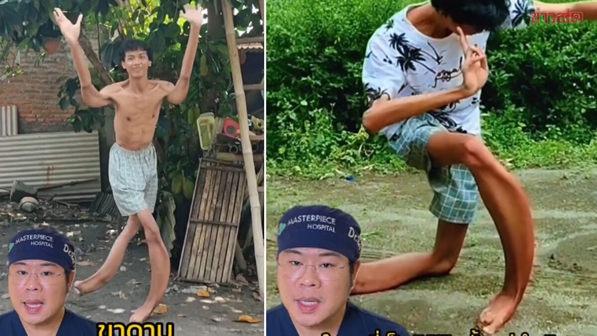 10 จังหวัดเสี่ยง ทารกที่คลอดออกมา ป่วยโรค "ขาดาบ" เกิดจากติดเชื้อซิฟิลิสตั้งแต่อยู่ในครรภ์
