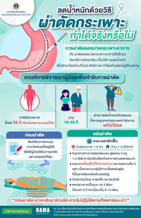 เพจดัง เปิดข้อมูล ผ่าตัดกระเพาะเพื่อลดน้ำหนัก ไม่ใช่ใครก็ทำได้ เผยผลข้างเคียง