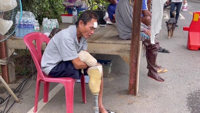 ลุงเชน วัย 64 ปี ขณะกำลังใส่ขาเทียม เพื่อทำกิจวัตรประจำวัน