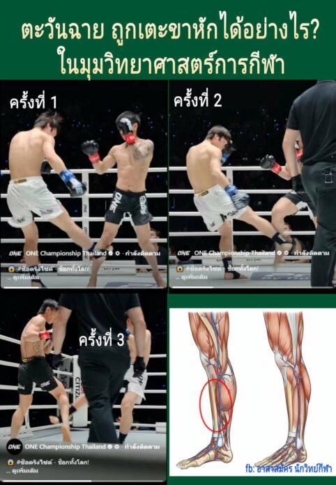 ตะวันฉาย โดนเตะขาหัก6