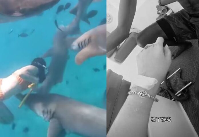 สาวจีนถูกฉลามกัด ขณะดำน้ำที่มัลดีฟส์