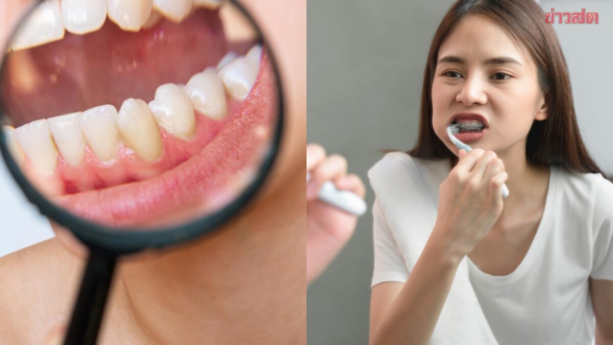 Dentist Reveals: Don't Rinse Immediately After Brushing Teeth - Easy Method to Strengthen Tooth Enamel