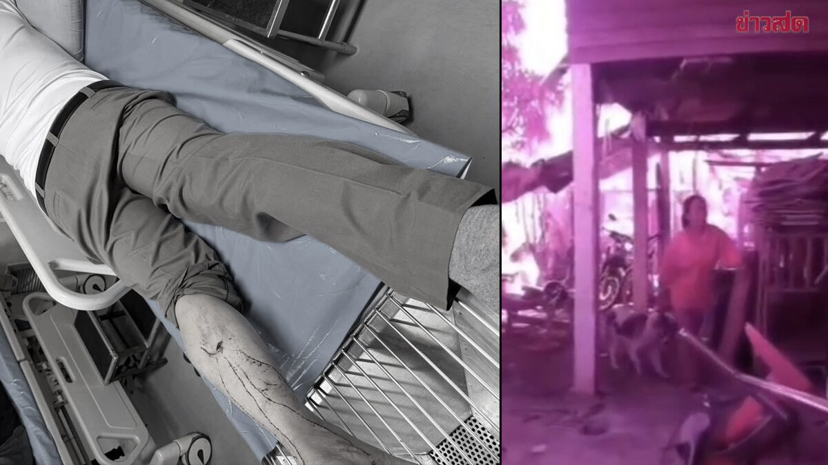 Drug Suspect's Protective Dog Bites Police Officer During Arrest