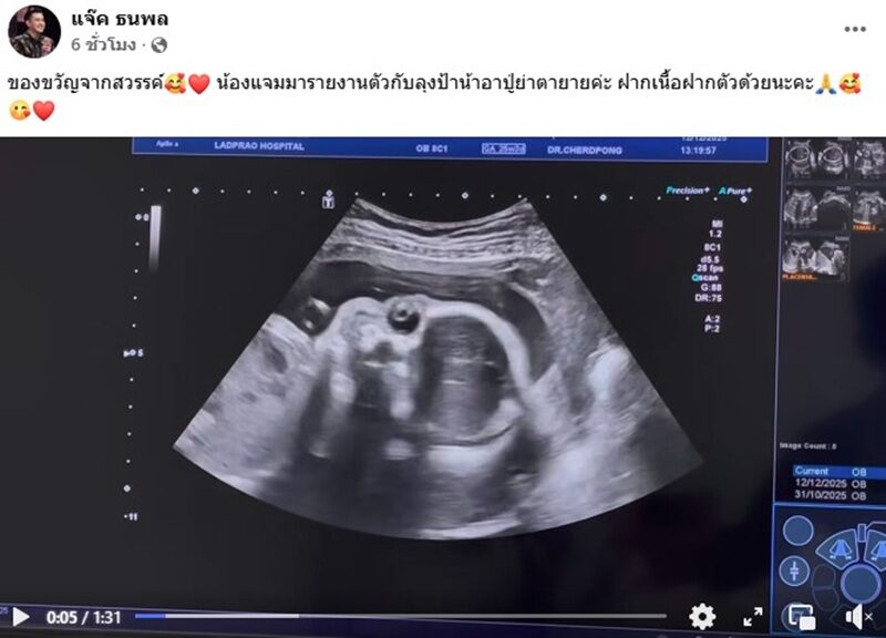 “แจ๊ค ธนพล” เผยข่าวดีรับปีใหม่