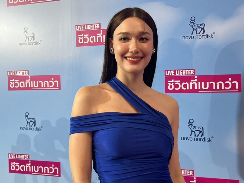 แจ็คกี้ หวนรับงานถี่ หลังปลูกผม