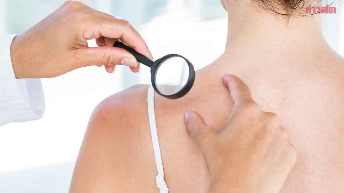 Check Immediately! Doctor Jed Reveals 4 Skin Signals Not to Ignore - Liver Health Warning