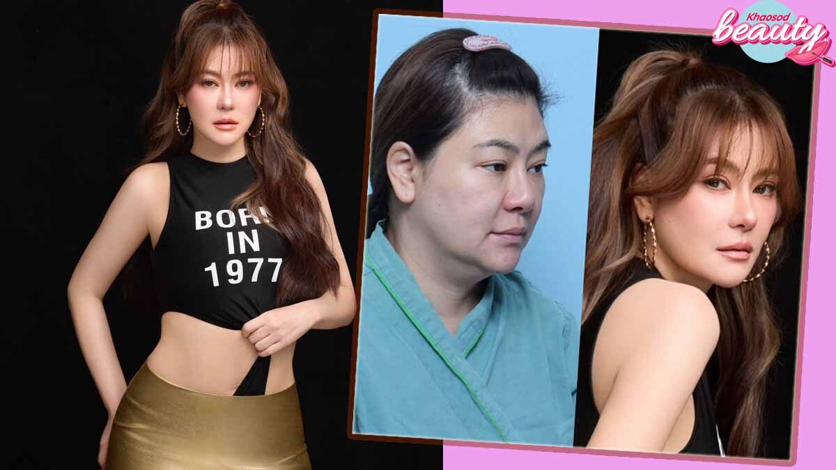 Age-Defying Beauty: Oh Pakjira Undergoes 6-Point Surgical Transformation