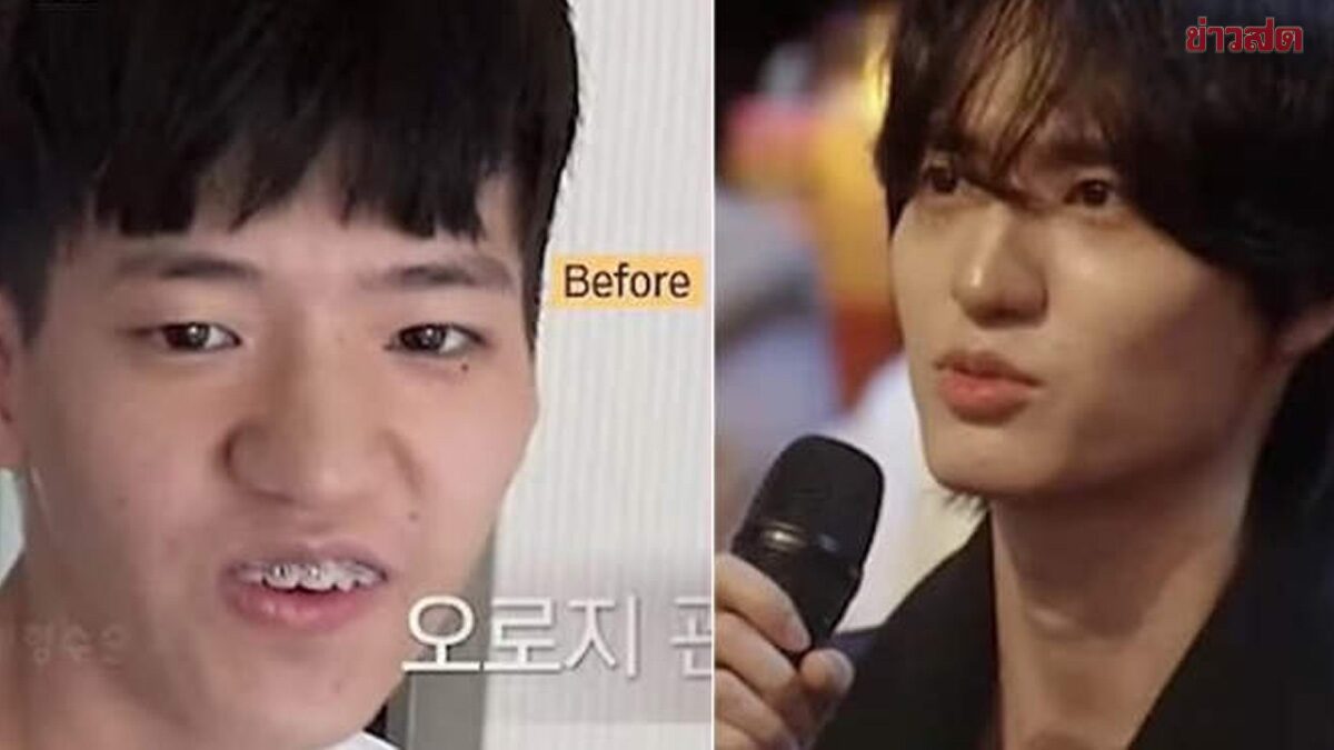 Internet Shocked! Young Man Transforms Like a Korean Idol, Insists 'No Plastic Surgery'