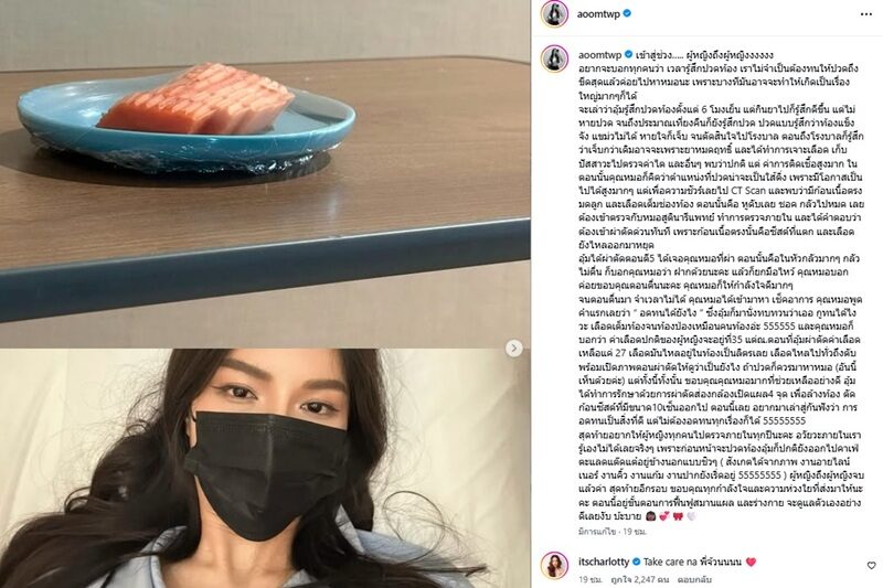 อุ้ม ทวีพร เล่านาทีซีสต์แตก