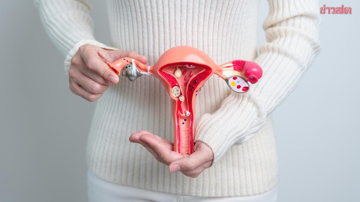 Warning! Do Not Overlook 9 Warning Signs of Uterine Fibroids