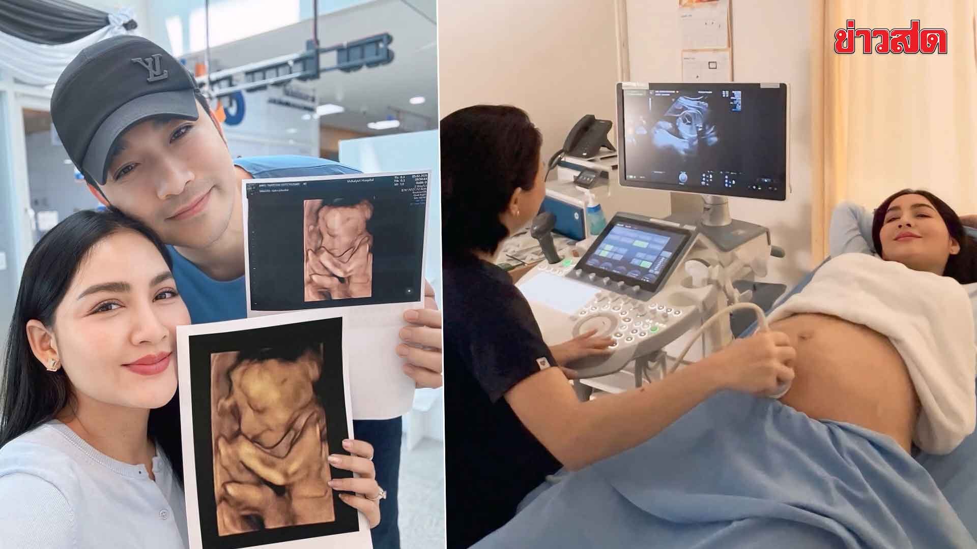 James Ruangsak Shares Ultrasound of Second Daughter, Revealing Her Cute Nose
