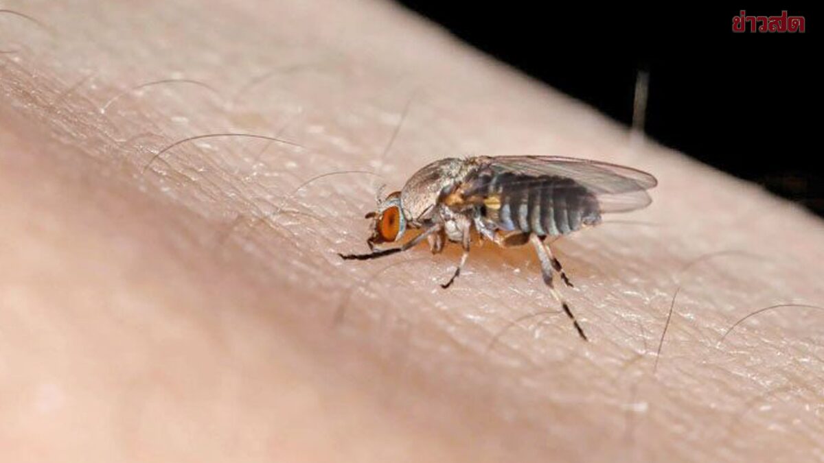 Doctors Advise: Insect Bite Inflammation Treatable, Avoid Unnecessary Antibiotics